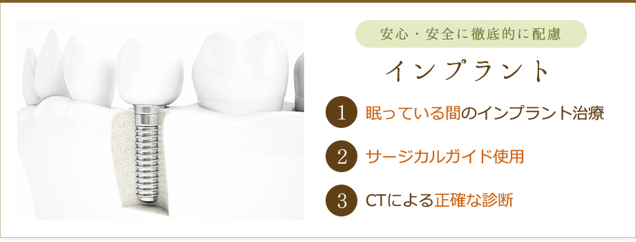 インプラント