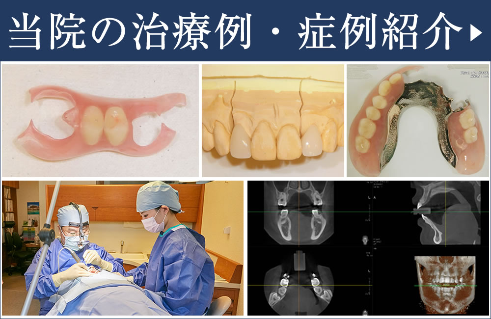 症例・治療例