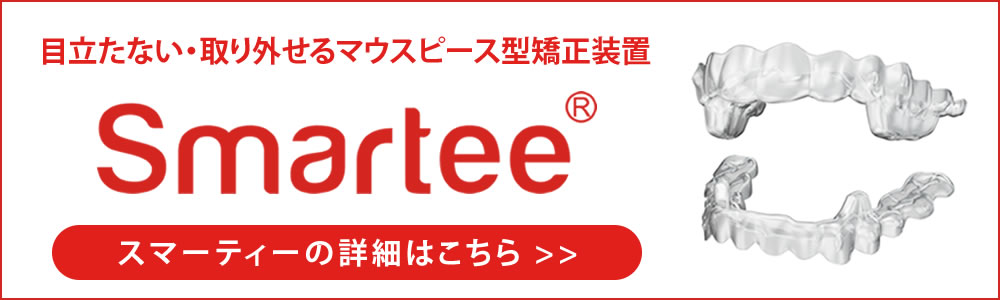 マウスピース型矯正装置「スマーティー」