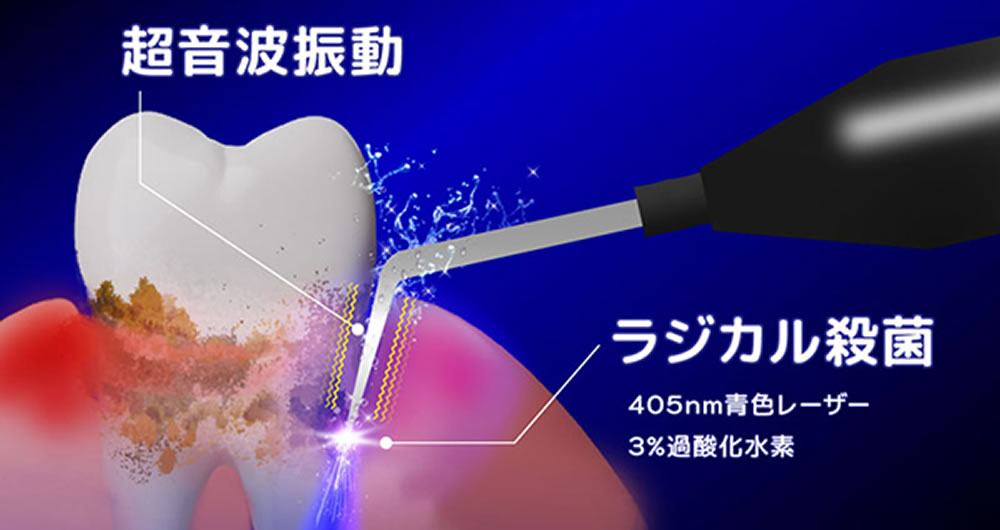 ブルーラジカルP-01（Blue Radical）とは？