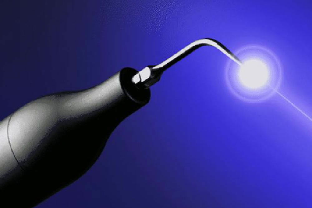 ラジカル殺菌・スケーリング